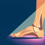 Topuk Dikeni Acısını Anında Hafifleten Ev Yapımı Çözümlera